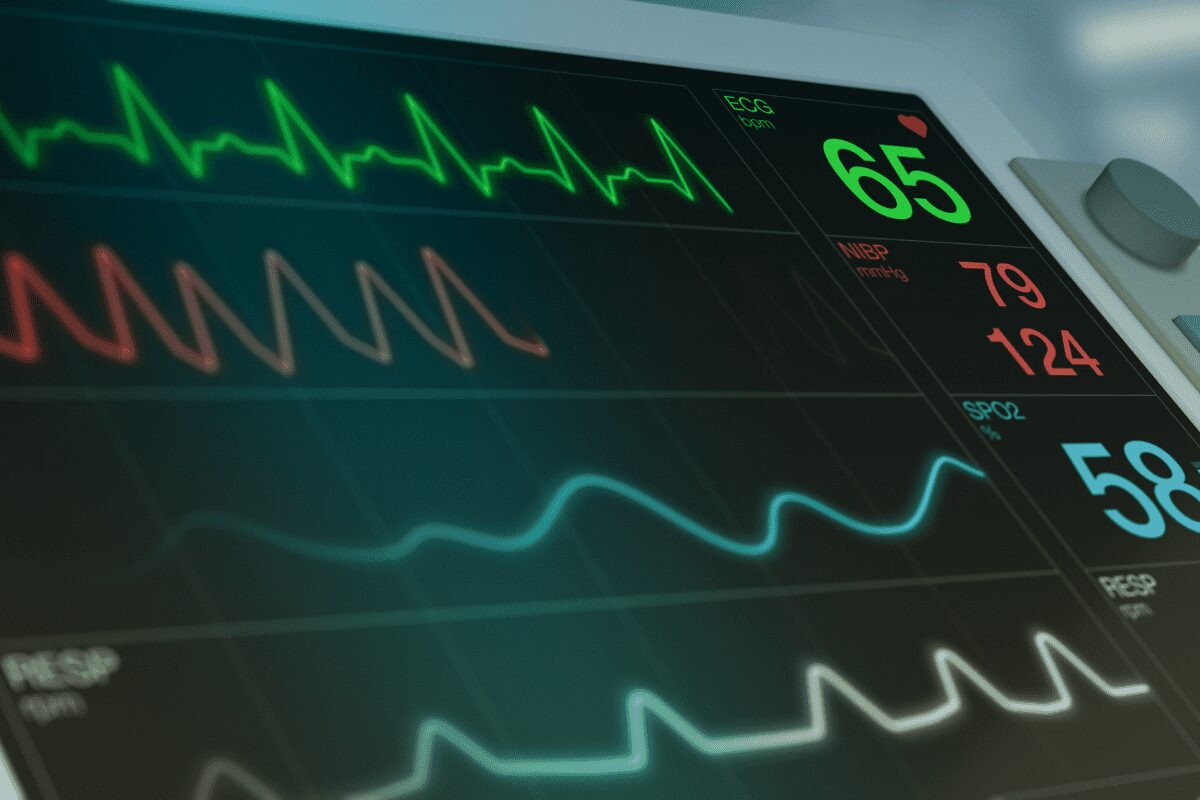 What Is an EKG featured